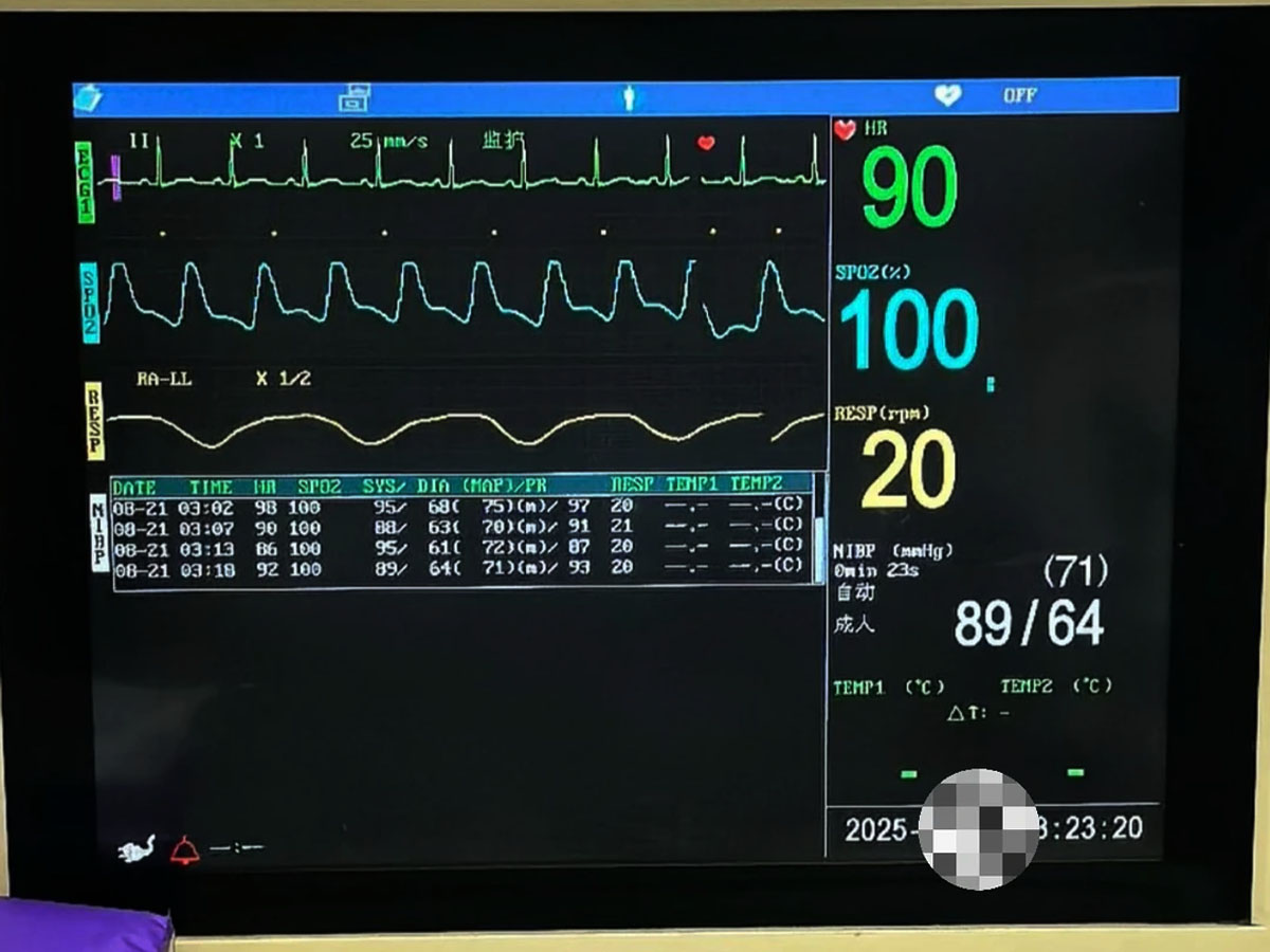 临床生命体征监护